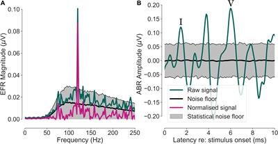 Acquisition of Subcortical Auditory Potentials With Around-the-Ear cEEGrid Technology in Normal and Hearing Impaired Listeners